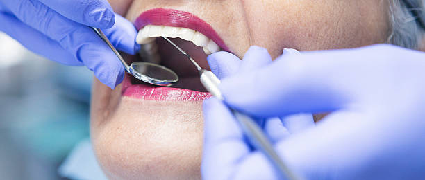 Best Knocked-Out Tooth Emergency  in Sea Ranch, CA